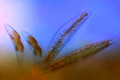 73. Okrzemki (Cymbella sp.) / Diatoms (Cymbella sp.)