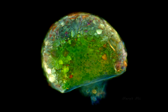 40. Ameba skorupkowa (Difflugia) / Shelled amoeba (Difflugia)