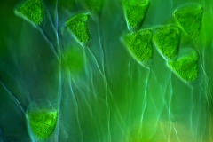 47. Kolonijne wirczyki z symbiotycznymi glonami / Colonial Vorticella with symbiotic algae
