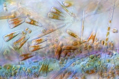 159. Okrzemki (przeważnie Gomphonema sp.) / Diatoms (mostly Gomphonema sp.)