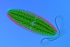 97. Desmid (Netrium sp.) i sinica / Desmid (Netrium sp.) and cyanobacteria