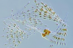 133. Dinobryon i bruzdnica (Ceratium hirundinella) / Dinobryon and dinoflagellate (Cerattium hirundinella)