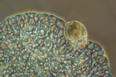 17. Słonecznica pożerająca wrotka / Heliozoan ingesting rotifer