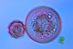 21. Ameby skorupkowe (Arcella sp.) / Testate amoebas (Arcella sp.)