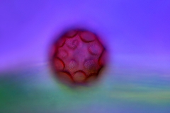 22. Ameba skorupkowa (Arcella sp.) / Testate amoeba (Arcella sp.)