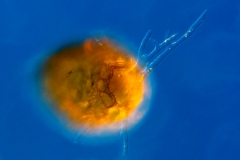 23. Ameba skorupkowa (Difflugia sp.) / Testate amoeba (Difflugia sp.)