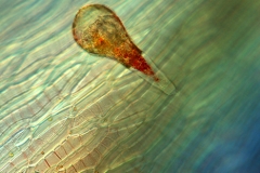 30. Ameba skorupkowa (Difflugia sp.) na torfowcu / Testate amoeba (Difflugia sp.) on Sphagnum