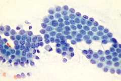 8. Cytologia szyjki macicy / Cervical cytology